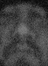 leech.jpg (16886 bytes)